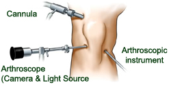 arthroscopic_surgery1 (1)
